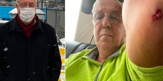 Ankara Emniyet Müdürlüğü Uğuroğlu’na yapılan saldırıyla ilgili açıklama yayınladı