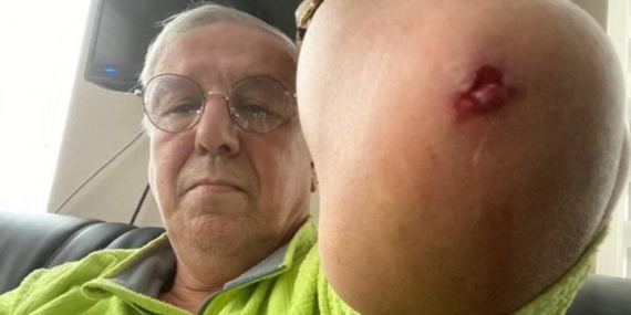 Gazeteci Orhan Uğuroğlu'na saldıran kişinin MHP'li belediyede çalıştığı ortaya çıktı! 6 Gazeteci Orhan Uğuroğlu’na saldıran kişinin MHP’li belediyede çalıştığı ortaya çıktı!