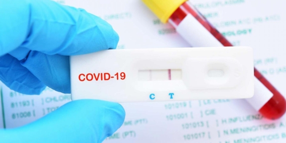 Covid-19 Testinin En Doğru Sonuç Verdiği Saat Belli Oldu 12 Covid-19 Testinin En Doğru Sonuç Verdiği  Saat Belli Oldu