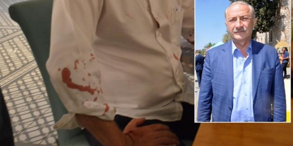 Didim Belediye Başkanı Atabay’a Sopalı Saldırı