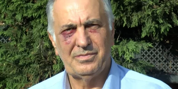 SALDIRIYA UĞRAYAN CEMEVİ BAŞKANI AÇIKLAMALARDA BULUNDU